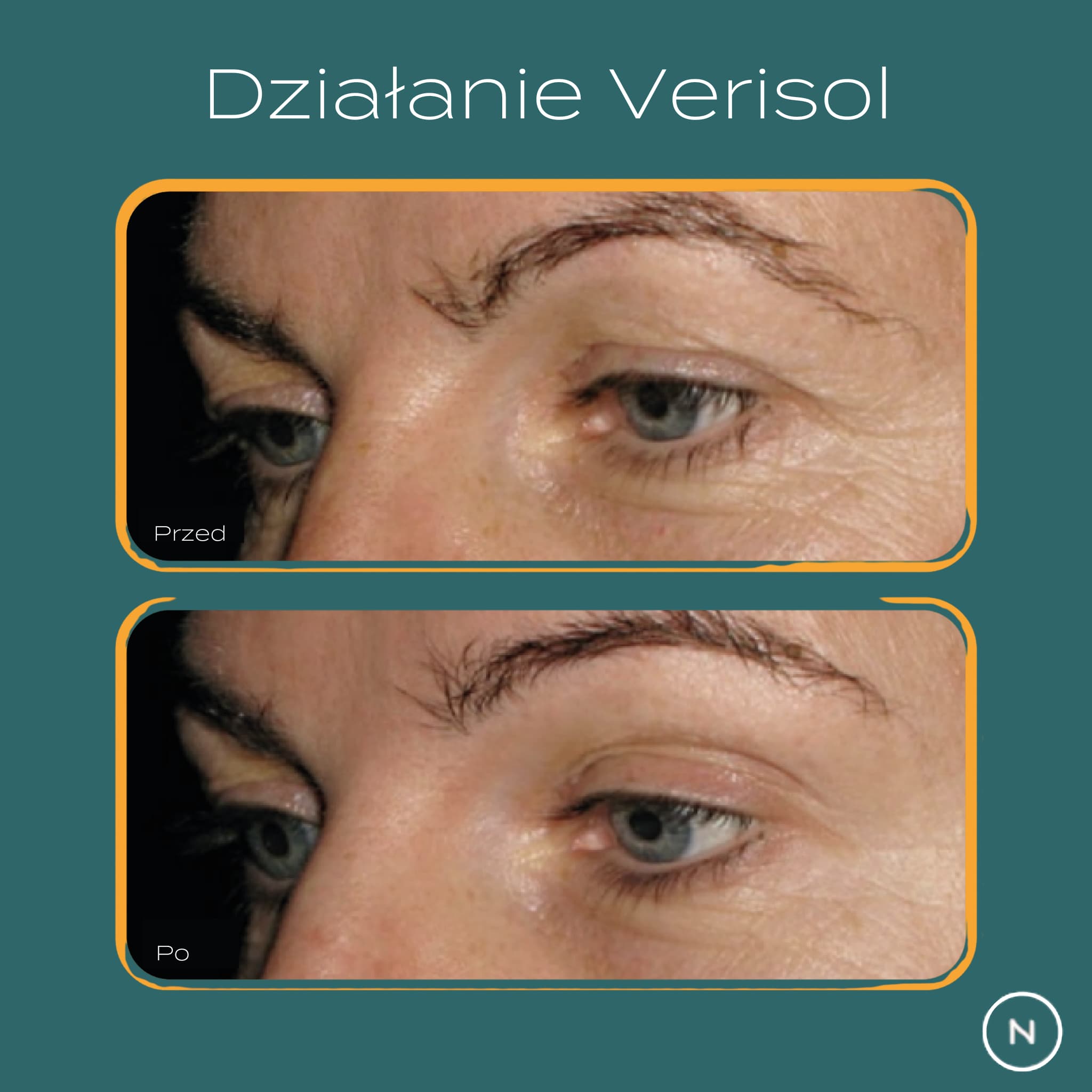 dzialanie verisol