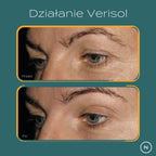 dzialanie verisol